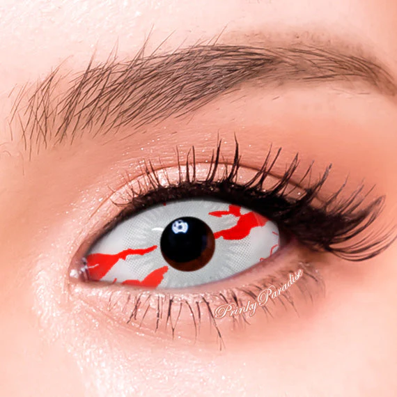 Princess Pinky Deadly Infectious Sclera
